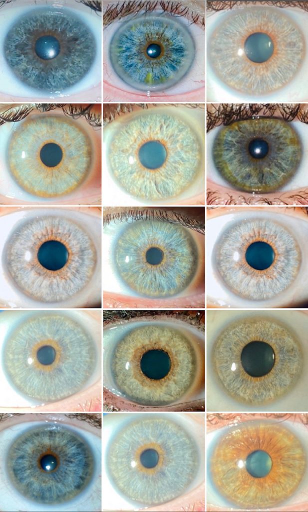 Current Neweyes Laser Eyecos. Eye color change